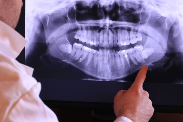 Best Walk-In Emergency Dental Services in Fall City, WA